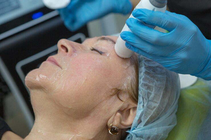 face-lifting-smas-lifting-ultrasonic-process-rejuvenation